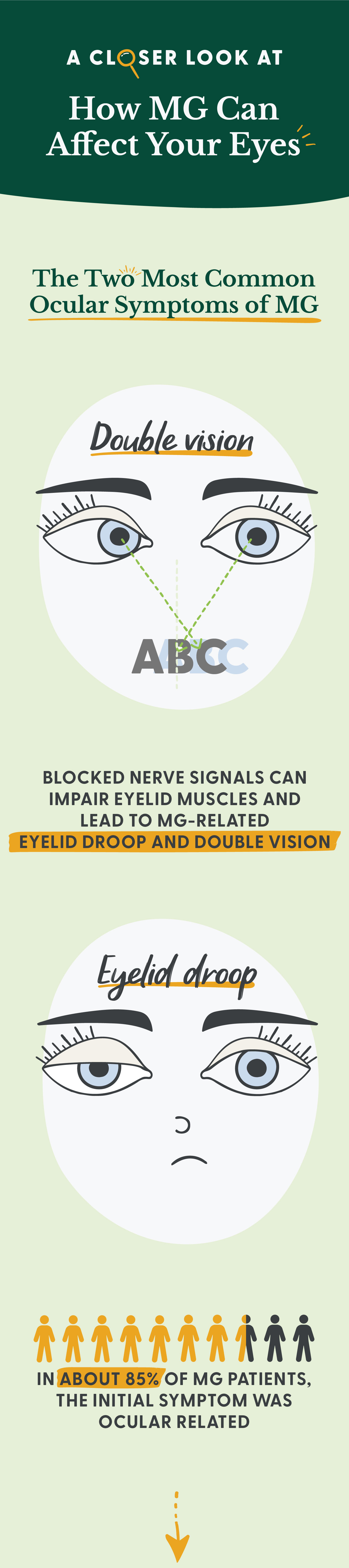 This graphic portrays the two most common ocular symptoms of MG. Double vision, or diplopia, means you see two images of a single object. And eyelid droop, or ptosis, means your upper eyelid (or eyelids) covers part of your eye. It has a fact that states, “Blocked nerve signals can impair eyelid muscles and lead to MG-related eyelid droop and double vision.” It also has a stat which says, “In about 85% of MG patients, the initial symptom was ocular related.”