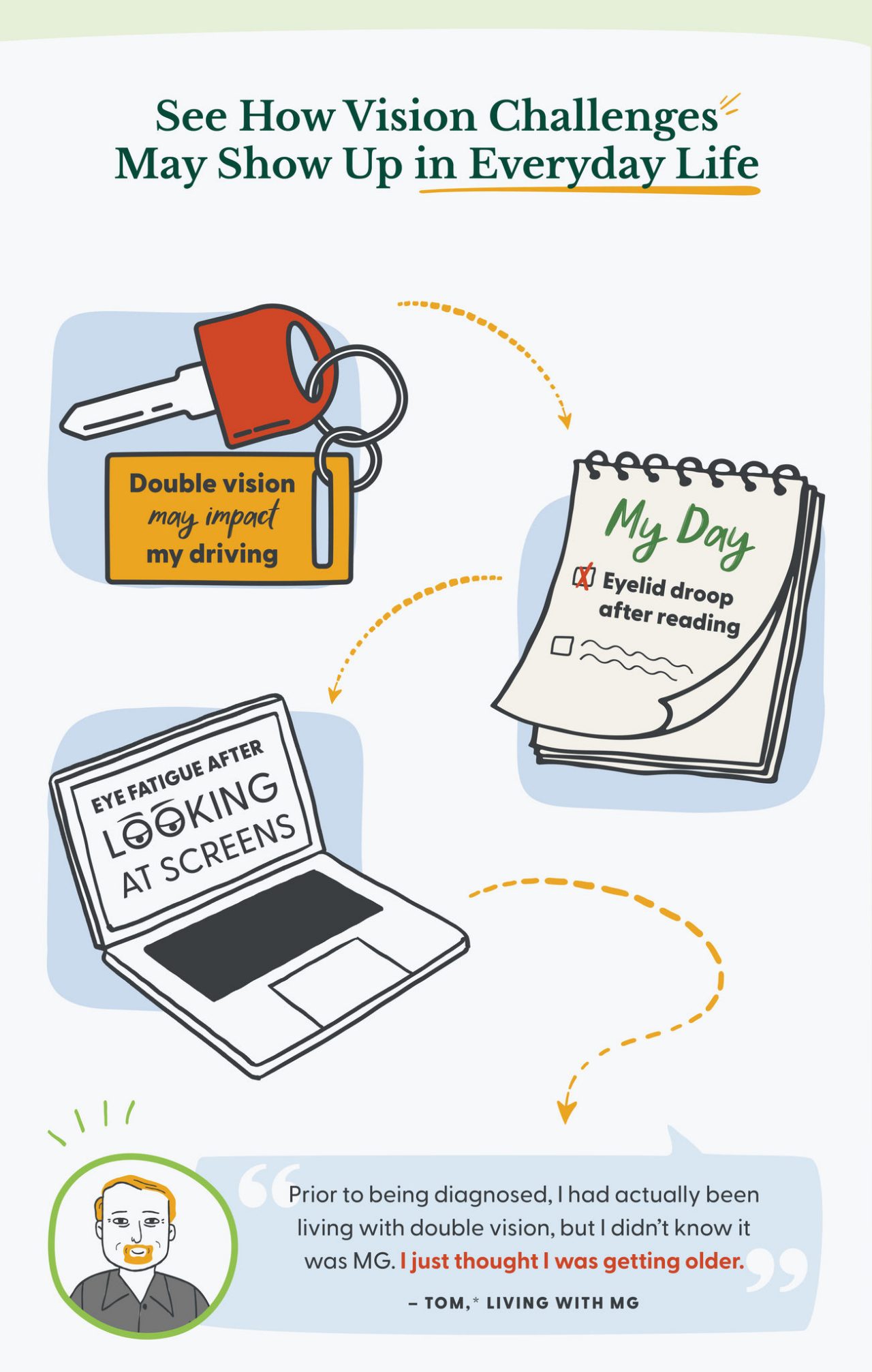 This graphic has three parts that show how vision challenges may show up in everyday life; they include: a stop sign with “Double vision may impact my driving,” a checklist that includes “Eyelid droop after reading” and a screen creating eye fatigue. A quote follows, “Prior to being diagnosed, I had actually been living with double vision, but I didn’t know it was MG. I just thought I was getting older.” Tom,* living with MG.
